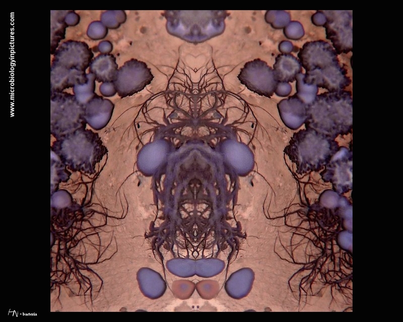 mixture of bacterial colonies